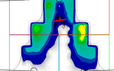 Female Bike Seat Pain: Why Women Suffer More than Men and Solutions to Eliminate Discomfort